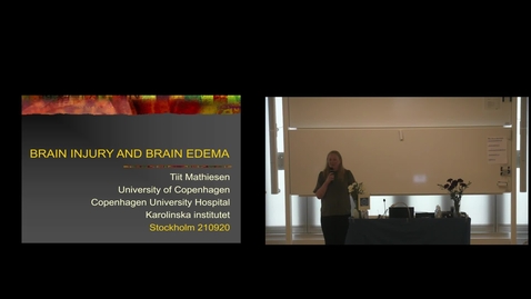 Thumbnail for Teng Wang PhD Defense at CBH/KTH - 210920: &quot;Electroosmosis Based Treatment Approach for Cerebral Edema - Evaluated with Finite Element Head Models&quot;