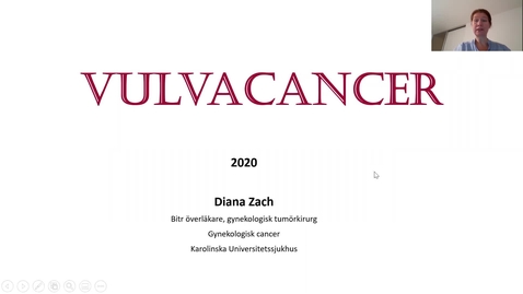 Thumbnail for Presentation Vulvacancer Zach Svenska 2020 Del 1