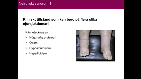 Thumbnail for Njursjukdomar del 2
