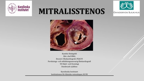Thumbnail for Ekokardiografi vid mitralisstenos