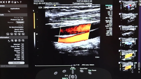 Thumbnail for BMA-programmet Karolinska Institutet - yrkesverksamma berättar