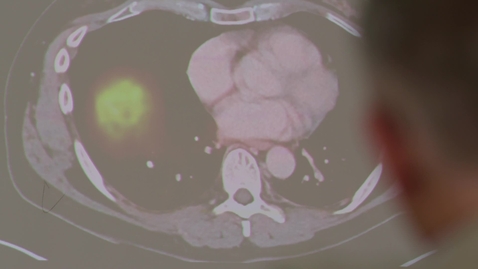 Thumbnail for Olof Akre: Wants to personalise prostate cancer treatment