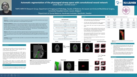 Thumbnail for Sohaib Shujaat -Poster Oral Health Symposium Precorded Video