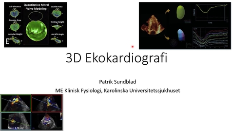 Thumbnail for 3D-ekokardiografi