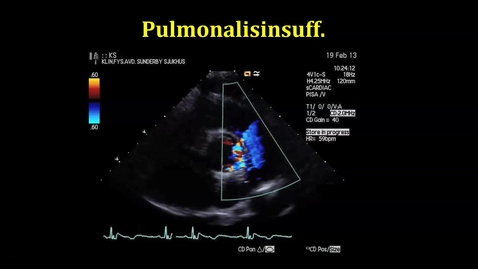 Thumbnail for Pulmonalisinsufficiens