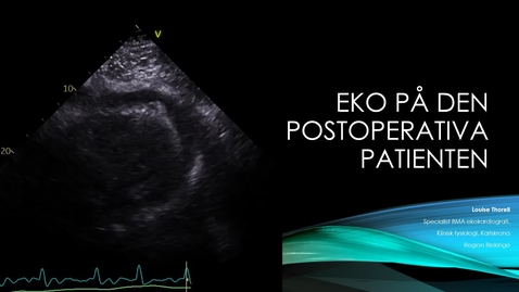 Thumbnail for Ekokardiografi på den postoperativa patienten