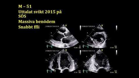 Thumbnail for Uttalat hjärtsvikt