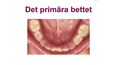 Thumbnail for DFSM Det primära bettet 20-11-11