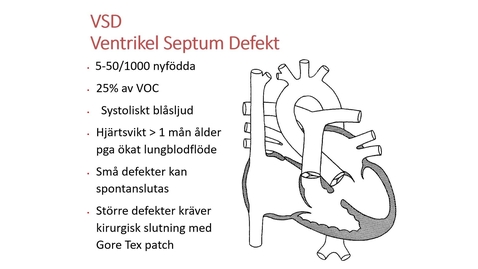 Thumbnail for Del 2. Barnkardiologi och Barnfysiologi - medfödda hjärtfel och kardiomyopatier