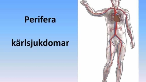 Thumbnail for Perifera kärlsjukdomar