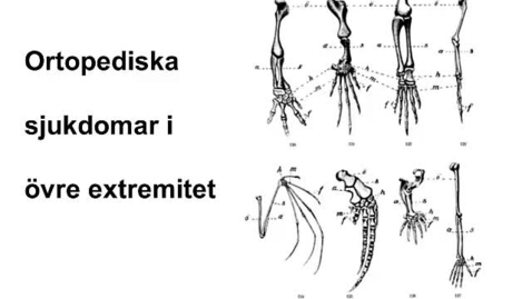 Thumbnail for Ortopediska sjukdomar i övre extremitet