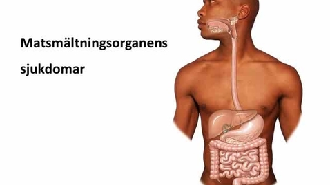 Thumbnail for Matsmältningsorganens sjukdomar