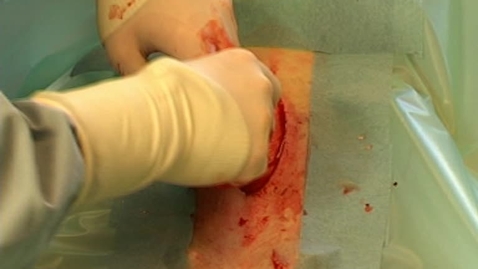 Thumbnail for Pyometra. Ovariehysterektomi. Hund