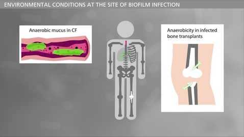 Thumbnail for BIOFILM - Bacteria and Chronic Infections - Treatment of Chronic Infections