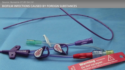 Thumbnail for BIOFILM - Bacteria and Chronic Infections - Intravascular Catheter