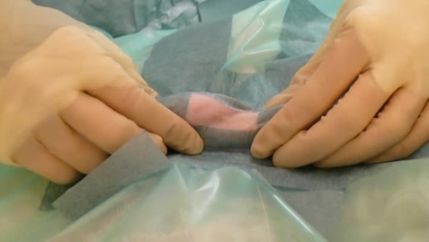 Thumbnail for Orchiectomy, Hund, Metode 2