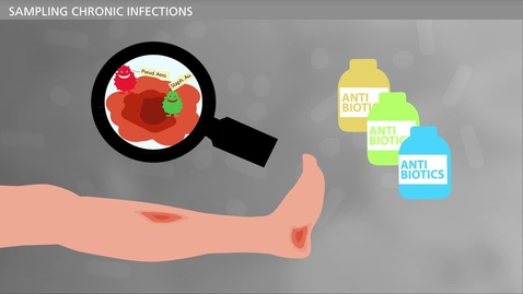 Thumbnail for BIOFILM - Bacteria and Chronic Infections - Diagnosis of Chronic Infections