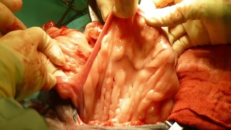 Thumbnail for Ovariectomi, Hund, m. ovarietang