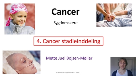 Thumbnail for Video4, Stadieinddeling, Cancer SGD, MEBO