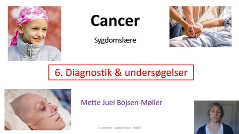 Thumbnail for Video6, Diagnostik us., Cancer SGD, MEBO